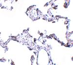 CD81 Antibody in Immunohistochemistry (Paraffin) (IHC (P))