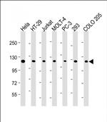 TERT Antibody in Western Blot (WB)