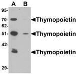 LAP2 Antibody in Western Blot (WB)