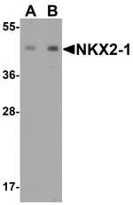 Nkx2.1 Antibody in Western Blot (WB)