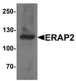 ERAP2 Antibody in Western Blot (WB)