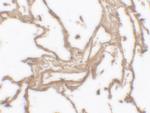 MMP9 Antibody in Immunohistochemistry (Paraffin) (IHC (P))