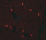 CD272 (BTLA) Antibody in Immunohistochemistry (Paraffin) (IHC (P))