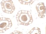 CD272 (BTLA) Antibody in Immunohistochemistry (Paraffin) (IHC (P))