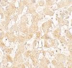 UCP1 Antibody in Immunohistochemistry (Paraffin) (IHC (P))