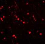 NOX2 Antibody in Immunohistochemistry (Paraffin) (IHC (P))