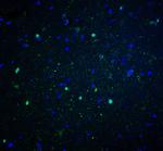 NOX2 Antibody in Immunohistochemistry (Paraffin) (IHC (P))