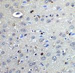 NOX2 Antibody in Immunohistochemistry (Paraffin) (IHC (P))