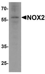 NOX2 Antibody in Western Blot (WB)