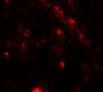 PIK3R4 Antibody in Immunohistochemistry (Paraffin) (IHC (P))