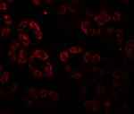 SKIV2L Antibody in Immunohistochemistry (Paraffin) (IHC (P))