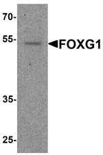 FOXG1 Antibody in Western Blot (WB)