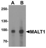 MALT1 Antibody in Western Blot (WB)