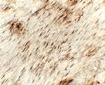 Golgin-97 Antibody in Immunohistochemistry (Paraffin) (IHC (P))