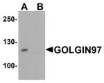 Golgin-97 Antibody in Western Blot (WB)