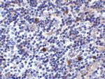 CD275 (B7-H2) Antibody in Immunohistochemistry (IHC)