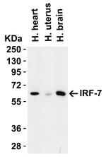 IRF7 Antibody in Western Blot (WB)