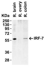 IRF7 Antibody in Western Blot (WB)