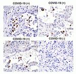 SARS-CoV-2 Spike Protein S1 Antibody in Immunohistochemistry (Paraffin) (IHC (P))