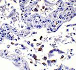 SARS-CoV-2 Spike Protein S1 Antibody in Immunohistochemistry (Paraffin) (IHC (P))