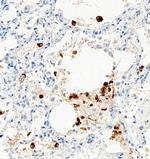 SARS-CoV-2 Spike Protein S1 Antibody in Immunohistochemistry (Paraffin) (IHC (P))