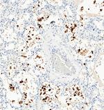 SARS-CoV-2 Spike Protein S1 Antibody in Immunohistochemistry (Paraffin) (IHC (P))