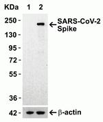 SARS-CoV-2 Spike Protein S1 Antibody in Western Blot (WB)