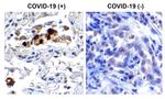 SARS-CoV-2 Spike Protein (RBD) Antibody in Immunohistochemistry (Paraffin) (IHC (P))