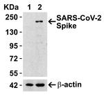 SARS-CoV-2 Spike Protein (RBD) Antibody in Western Blot (WB)