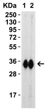 SARS-CoV-2 Spike Protein (RBD) Antibody in Western Blot (WB)