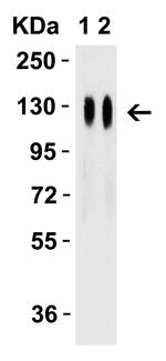 SARS-CoV-2 Spike Protein (RBD) Antibody in Western Blot (WB)