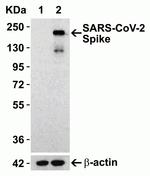 SARS-CoV-2 Spike Protein S1 Antibody in Western Blot (WB)