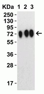 SARS-CoV-2 Spike Protein S1 Antibody in Western Blot (WB)