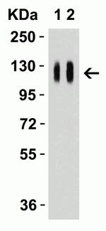 SARS-CoV-2 Spike Protein S1 Antibody in Western Blot (WB)