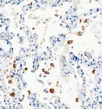 SARS-CoV-2 Nucleocapsid Antibody in Immunohistochemistry (Paraffin) (IHC (P))