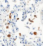 SARS-CoV-2 Nucleocapsid Antibody in Immunohistochemistry (Paraffin) (IHC (P))