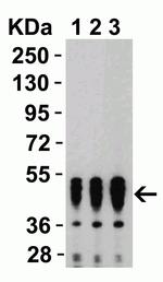 SARS-CoV-2 Nucleocapsid Antibody in Western Blot (WB)