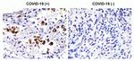 SARS-CoV-2 Spike Protein S2 Antibody in Immunohistochemistry (Paraffin) (IHC (P))