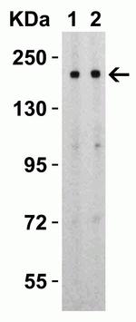 SARS-CoV-2 Spike Protein S2 Antibody in Western Blot (WB)