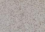 H3K27me3 Antibody in Immunohistochemistry (Paraffin) (IHC (P))