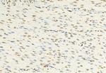 H3K27me3 Antibody in Immunohistochemistry (Paraffin) (IHC (P))