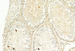 H3K27me3 Antibody in Immunohistochemistry (Paraffin) (IHC (P))