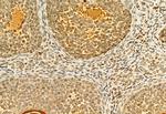 H3K27me3 Antibody in Immunohistochemistry (Paraffin) (IHC (P))