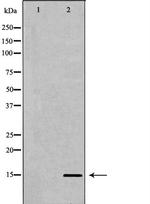 H3K27me3 Antibody in Western Blot (WB)