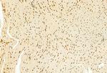 H3K4me3 Antibody in Immunohistochemistry (Paraffin) (IHC (P))