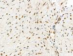 Phospho-4EBP1 (Thr37, Thr46) Antibody in Immunohistochemistry (Paraffin) (IHC (P))