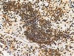 Phospho-4EBP1 (Thr37, Thr46) Antibody in Immunohistochemistry (Paraffin) (IHC (P))