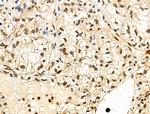 Phospho-4EBP1 (Thr37, Thr46) Antibody in Immunohistochemistry (Paraffin) (IHC (P))