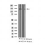 Phospho-ABL1/ABL2 (Tyr393, Tyr439) Antibody in Western Blot (WB)