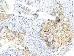 Phospho-Catenin alpha-1 (Ser655, Thr658) Antibody in Immunohistochemistry (Paraffin) (IHC (P))